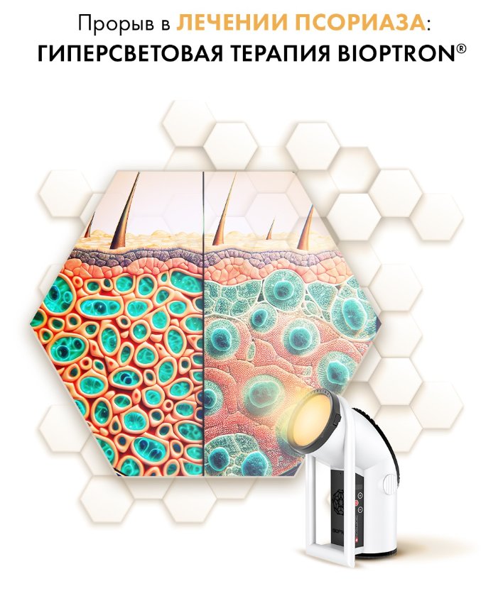 Прорыв в лечении псориаза: Гиперсветовая терапия BIOPTRON®