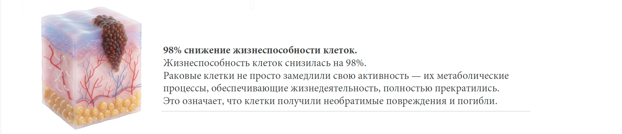 Bioptron-меланома2.jpg